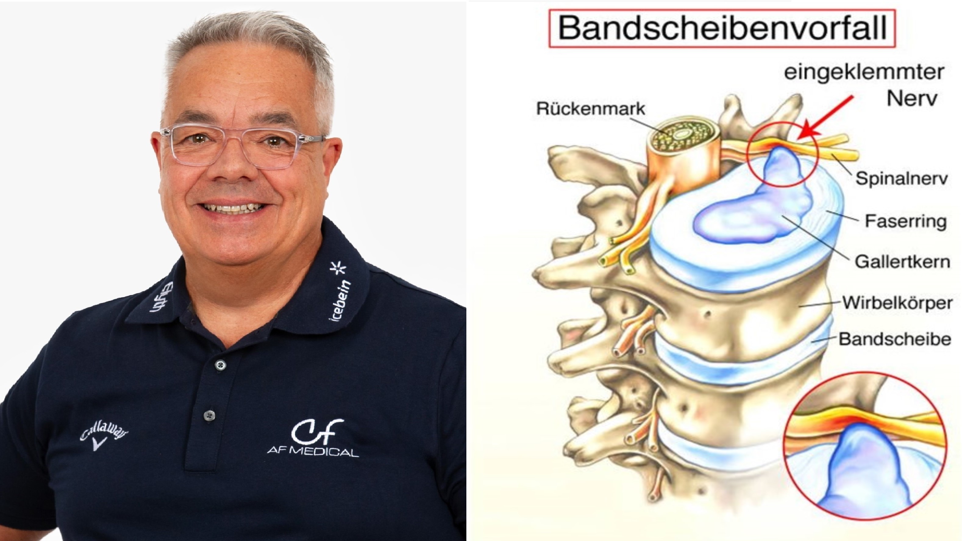 Ryder-Cup-Physio Artur Frank erklärt Ursachen und Therapiemöglichkeiten bei Schmerzen im Rücken.